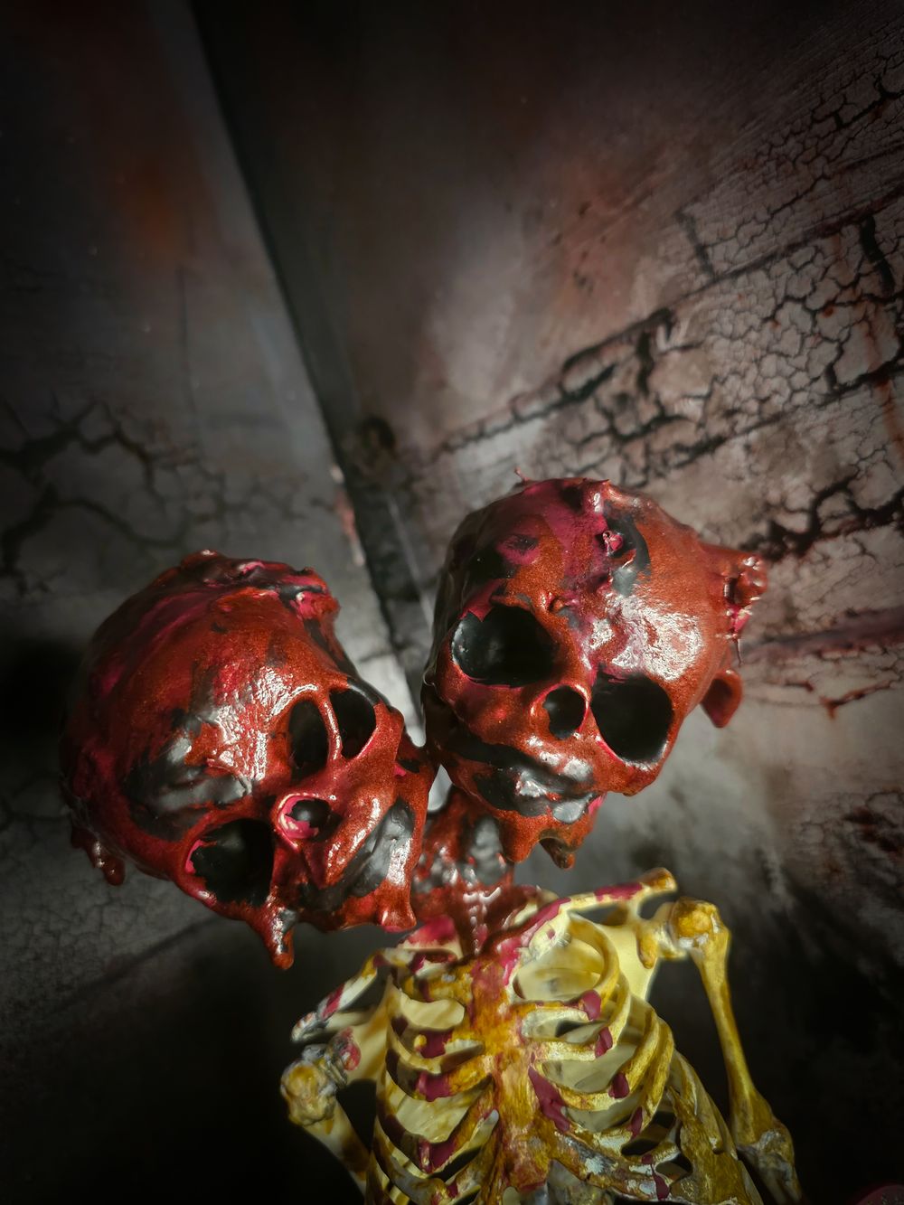 Bone Us