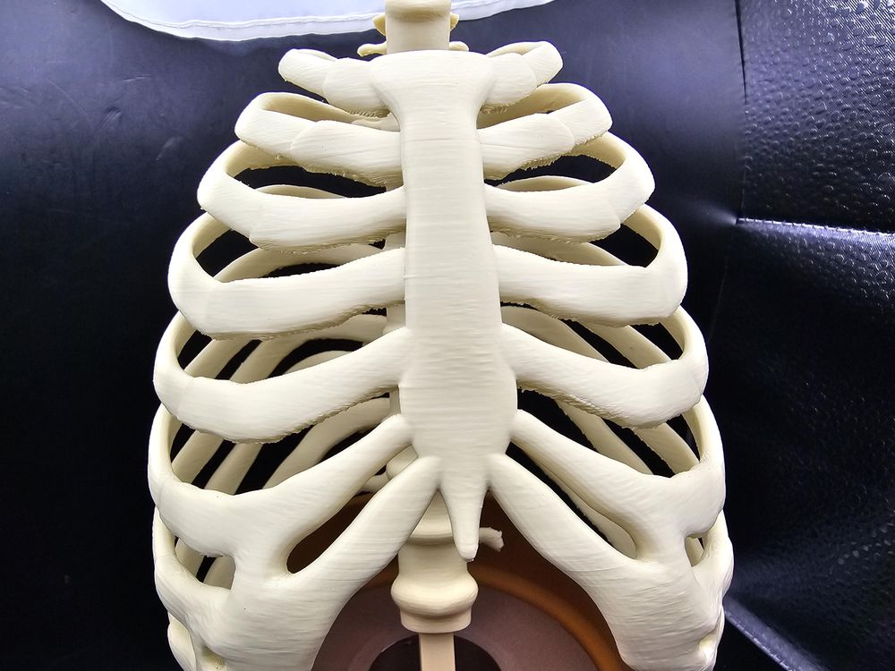 Rib Cage Plant Trellis